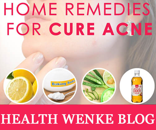 Remedies-To-Cure-Acne