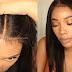 DANGERS INVOLVED IN BLEACHING