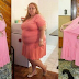 Weight Loss Surgery, Loose Skin, and Post-Bariatric Surgery