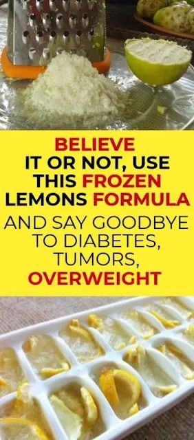 Believe it or Not, Use Frozen Lemons and Say Goodbye to Diabetes, Tumors, Obesity!