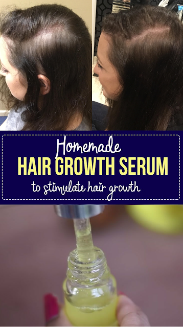 Homemade diy hair growth serum to stimulate hair & stop hair fall