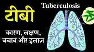 world-tuberculosis-day-vishwa-tapedik-divas