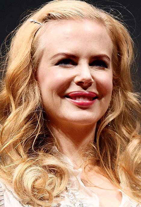 Nicole Kidman Redhead. Nicole Kidman Before Surgery