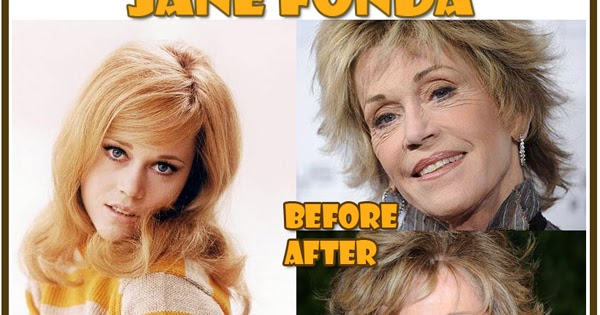 Jane Fonda Plastic Surgery Before and After | Plastic Surgery