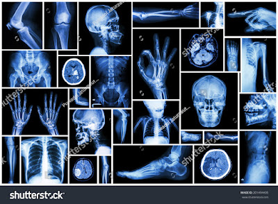 x-ray-in-hindi