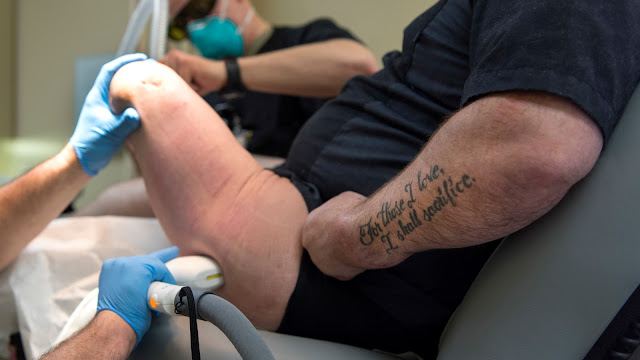 A wounded warrior receives laser treatment to improve the scar tissue of his amputated leg at the MacDill Air Force Base, Fla., scar clinic Feb. 15, 2019. (U.S. Air Force photo by Airman 1st Class Caleb Nunez)