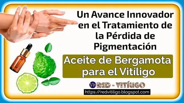 Aceite de Bergamota para el Vitíligo:  Exploración Científica en el Tratamiento de la Pérdida de Pigmentación