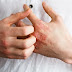 Most Common Food Allergies you must know