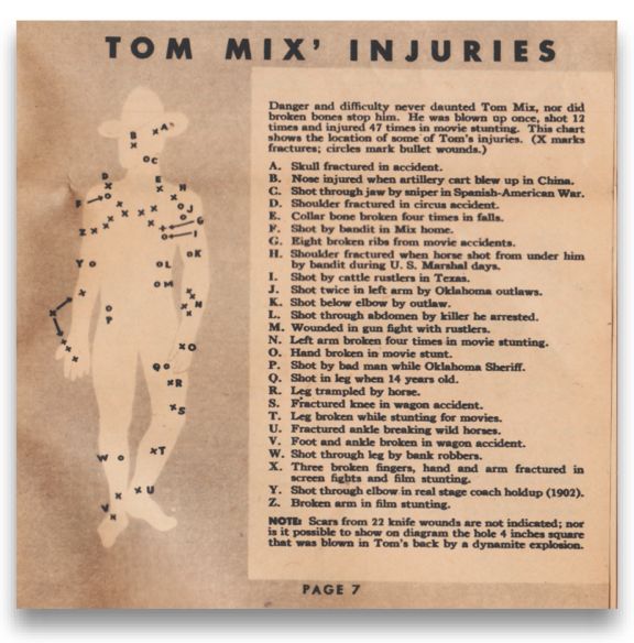 Shooter of the era is the detailed diagram of Tom Mix injuries