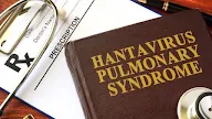 Pria di China Meninggal karena Hantavirus, Bagaimana Mencegah Paparannya? 