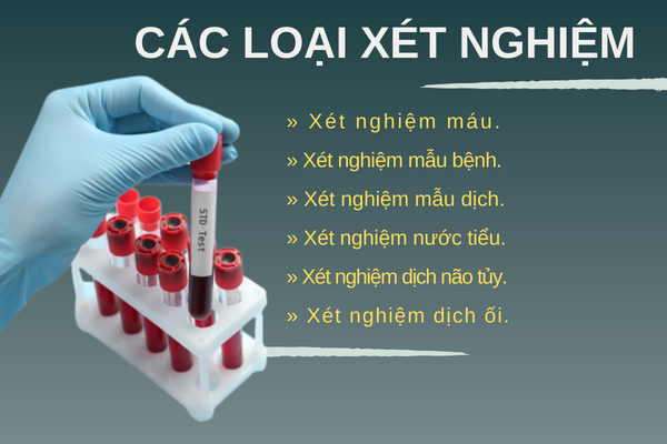 Các hình thức xét nghiệm bệnh xã hội