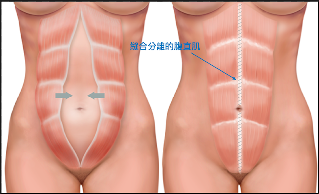 專長為：腹部抽脂整形、手臂抽脂整形、大腿抽脂整形、臉部拉提、上半身拉提手術、下半身拉提手術、乳房整形手術、隆乳手術、縮乳手術、提乳手術、乳頭整形、雙眼皮手術、下眼袋手術、開眼頭手術、開眼尾手術、鼻整形手術