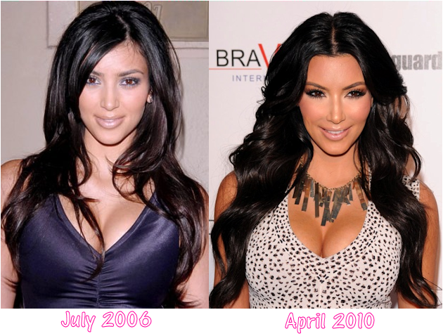 Star Plastic Surgery Before and After: December 2012