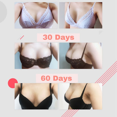 operasi payudara, operasi plastik korea, oplas korea, implan payudara, breast surgery, plastic surgery, dokter korea, konsultasi, payudara indah, operasi mudah, penyembuhan cepat, payudara besar