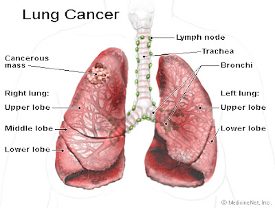 Lung Cancer Staging  Sign Ribbon cells Horoscope Symbol Tattoos Research Zodiac Sign Ribbon Tattoos