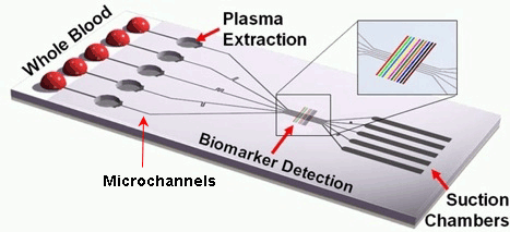 A schematic diagram of a  lab-on-a-chip