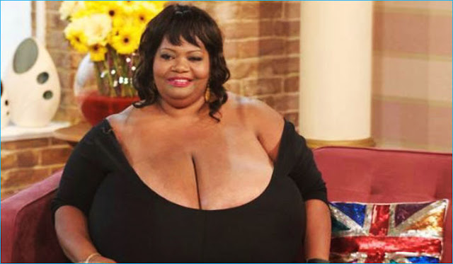 senos tetas mas grandes del mundo norma stitz