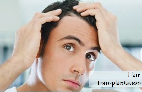 Hair Transplant and Diabetes