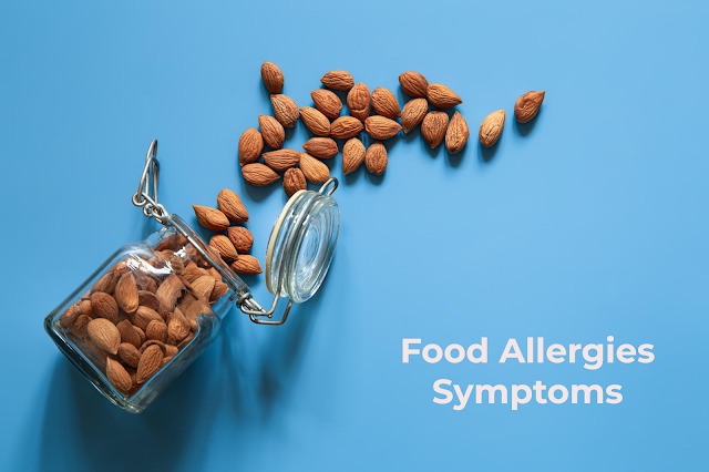 Food Allergies Symptoms