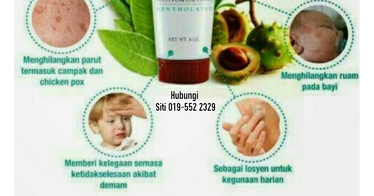 Ubat Luka Untuk Bayi - Contoh Jos