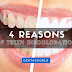 4 Causes of Teeth Discoloration