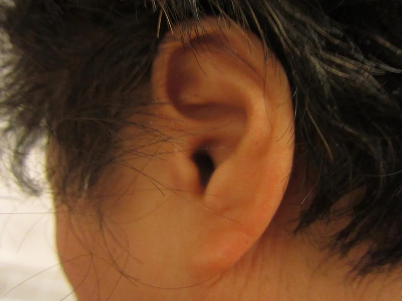 zaburzenia-słuchu