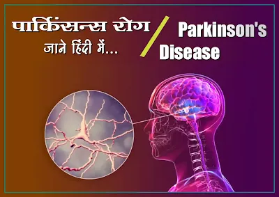 Parkinson's disease in hindi, Parkinson's treatment in hindi