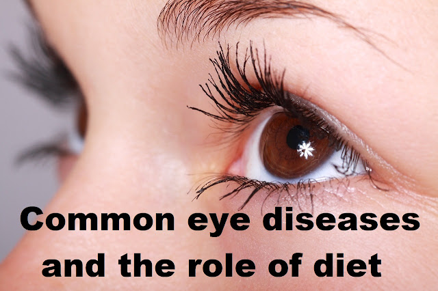 Common eye diseases and the role of diet