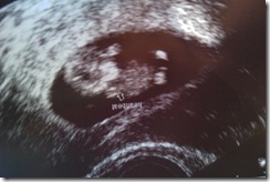 Sonogram_12weeks