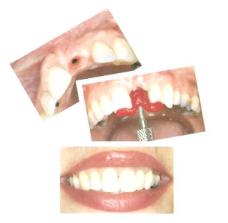 invisalign, sedation dentistry,  implants dentist,  cosmetic dentistry veneers 