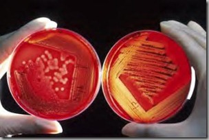Agar plates