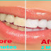 How To Whiten Your Teeth At Home In 2 Minutes How To Whiten Your Teeth At Home In 2 Minutes