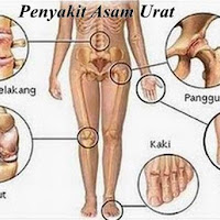 Asam Urat Dan Tekanan Darah Tinggi