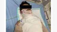 Kesal Gara-gara Knalpot Dijual ke Orang Lain, Mahasiswa Dibakar Sahabatnya Sendiri di Yogyakarta
