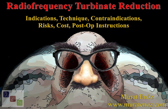 Radiofrequency Turbinate Reduction Definition - Radiofrequency Turbinate Reduction Indications - Radiofrequency Turbinate Reduction Video - Radiofrequency Turbinate Reduction Contraindications - Radiofrequency Turbinate Reduction Technique - Radiofrequency Turbinate Reduction Cost - Radiofrequency Turbinate Reduction in Istanbul - Radiofrequency Turbinate Reduction in Turkey - Radiofrequency Ablation of Hypertrophied Nasal Turbinates - Radiofrequency Treatment For Inferior Turbinate Hypertrophy - Inferior Turbinate Radiofrequency Reduction - Hypertrophy Of The Inferior Turbinates - Turbinate Reduction - Radiofrequency Tissue Reduction For Turbinate Hypertrophy - Radiofrequency Ablation (RFA) Of The Inferior Turbinates - Nasal Turbinate Radiofrequency - Radio Frequency Turbinate Reduction Post-Op Instructions - Radiofrequency Volumetric Inferior Turbinate Reduction - Is Computerized Tomography Required Before Turbinate Radiofrequency Operation - Can Turbinates Actually Regrow After Surgery? - Can Turbinates Actually Regrow After Radiofrequency? - Can Turbinates Actually Regrow After Radiofrequency Ablation? - Treatment of Rhinitis Medicamentosa - Radiofrequency Volumetric Reduction (RAVOR) For Inferior Turbinate - Coblation Inferior Turbinate Reduction - Inferior Turbinate Hypertrophy -Empty Nose Syndrome - Radiofrequency Turbinate Reduction Risks - Excessive Turbinate Reducing Risks - Radiofrequency Turbinate Reduction Complication - Turbinate Resection Risks - Nasal Crime - Turbinectomy - Intranasal Synechia - Intra-nasal Adhesion - Nasal adhesion - Radiofrequency Turbinate Reduction Cost - Cost of Radiofrequency Turbinate Reduction - Radiofrequency Turbinate Reduction Cost in Istanbul - Cost of Radiofrequency Turbinate Reduction in Turkey - Cost of Turbinate Hypertrophy Treatment in Istanbul - Treatment of Turbinate Hypertrophy Cost in Istanbul - Treatment of Turbinate Hypertrophy Cost in Turkey - Radiofrequency Turbinate Reduction Post-Op Instructions - Post-Operative Instruction For Radiofrequency Turbinate Reduction - Post-operative Instructions for Turbinate Reduction - Postoperative Instructions for Turbinate Radiofrequency - Before and After Photos For Radiofrequency Turbinate Reduction in Istanbul - Before and After Photos for Turbinate Radiofrequency - Before and After Photos for Septoplasty - Before and After Photos for Turbinate Radiofrequency in Istanbul - Before and After Photos for Turbinate Radiofrequency Reduction in Istanbul - Before and After Photos for Turbinate Radiofrequency Reduction in Turkey - Can Turbinates Actually Regrow After Radiofrequency Reduction? - Turbinate Regrow / Hypertrophy Again After Turbinate Radiofrequency - Turbinate Regrowing - Turbinate Radiofrequency Indications - Indications For Turbinate Radiofrequency - Treatment of Turbinate Hypertrophy - Radiofrequency Reducing For Treatment of Turbinate Hypertrophy - Turbinate Enlargement - Radiofrequency Turbinate Reduction in Istanbul - Treatment of Inferior Turbinate Hypertrophy - Treatment of Inferior Turbinate Hypertrophy in Istanbul -  Treatment of Inferior Turbinate Hypertrophy in Turkey