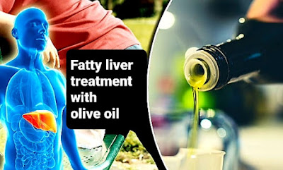 Fatty liver treatment with olive oil    علاج الكبد الدهني بزيت الزيتون