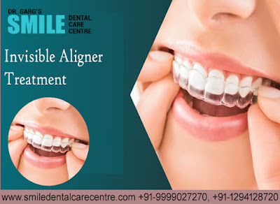 Best Invisible Aligner Treatment