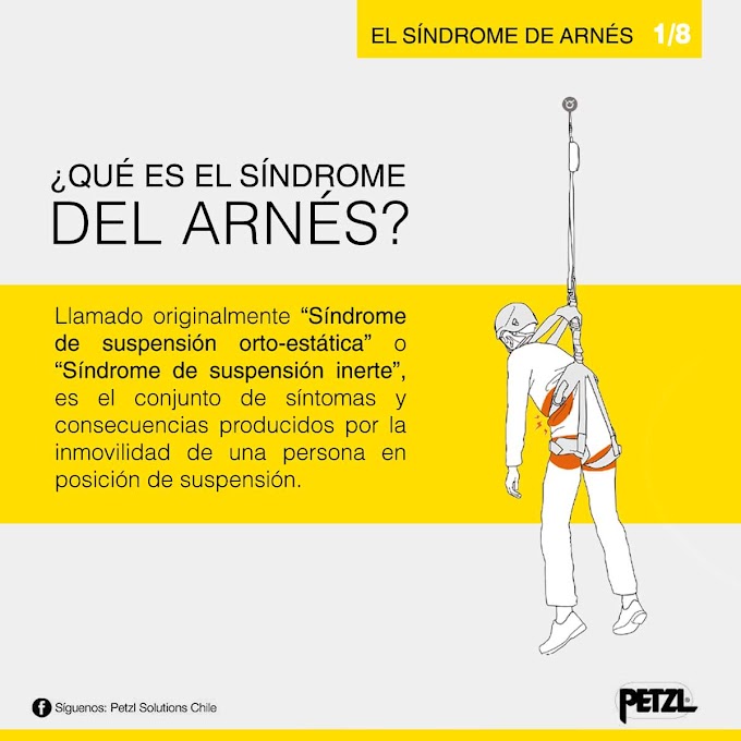 Que es el síndrome del arnés