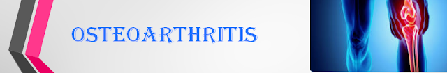 Osteoarthritis