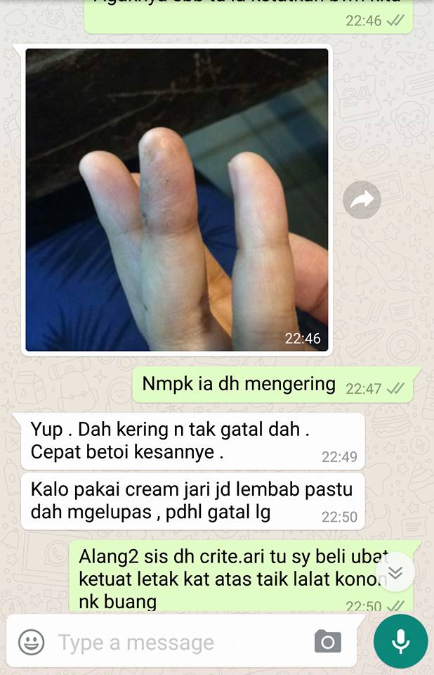 Mommy meletop: Manjakani untuk kulit gatal berair