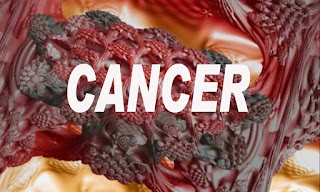 The types of cancer, how to prevent and treatment