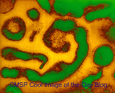 common cold virus diagram. house common cold virus