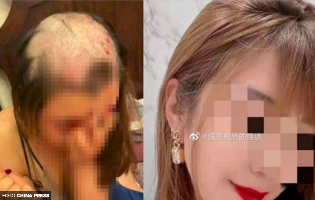 Suami cukur rambut isteri sehingga botak tengah kerana didakwa curang