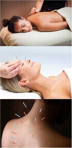 akupunktur uygulaması