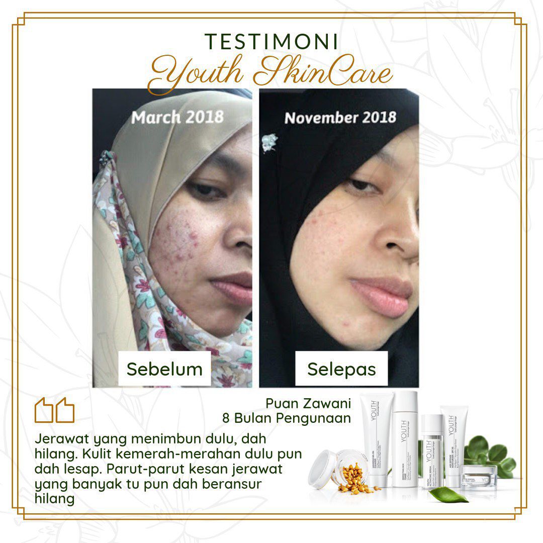 YOUTH Skincare Shaklee: Semulajadi dan Selamat Testimoni