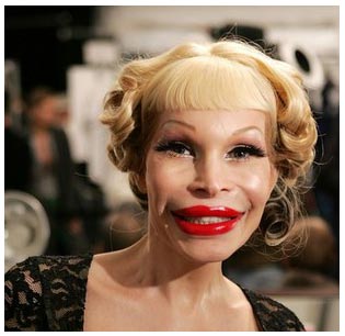 Celebrity Pictures Forum on Worst Celebrity Plastic Surgery   Page 7