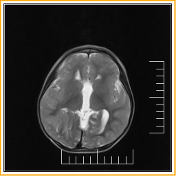 exemple d'introduction de vae   34