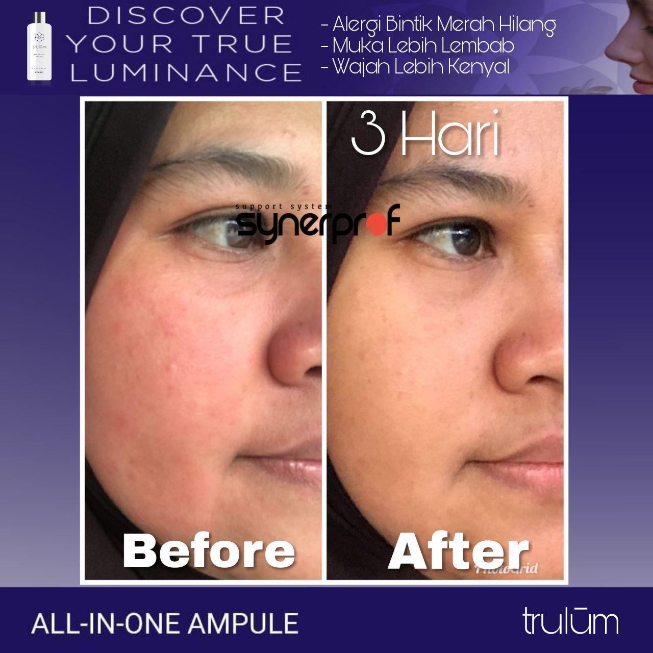 Jual Trulum Skincare Di Area Dringu, Probolinggo WA: 08112338376