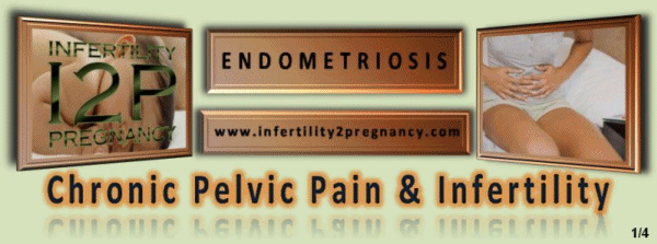 ENDOMETRIOSIS, could be the reason of chronic Pelvic Pain, so read it compleatly, possibly you will get your answere