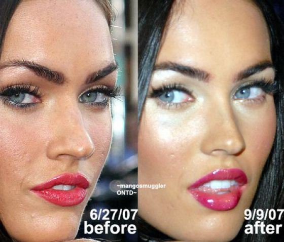 megan fox nose job before and after. Megan Fox Keira Knightley